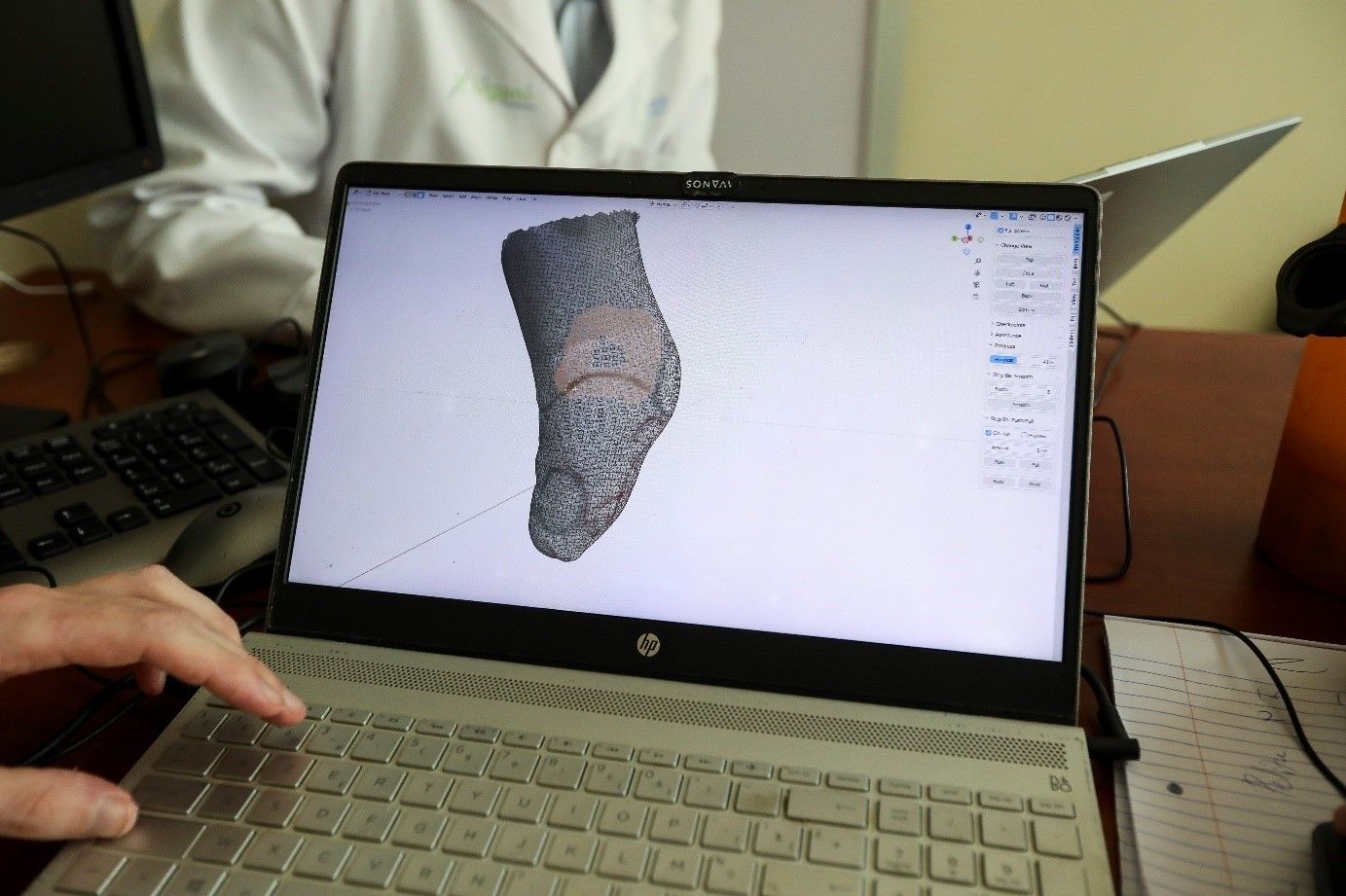Protesi 3D accessibili dal Belgio