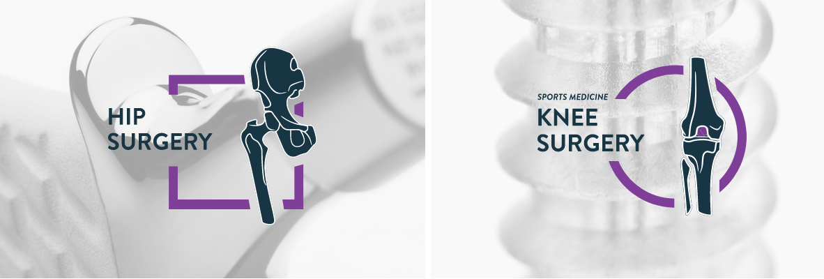 Protesi mediche avanzate per ortopedia e medicina sportiva